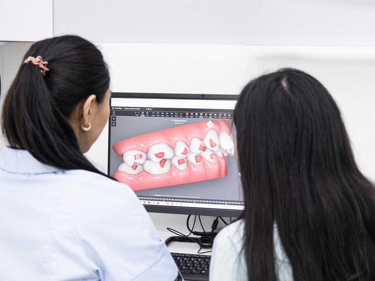 Can Clear Aligners Fix an Underbite? Everything You Need to Know